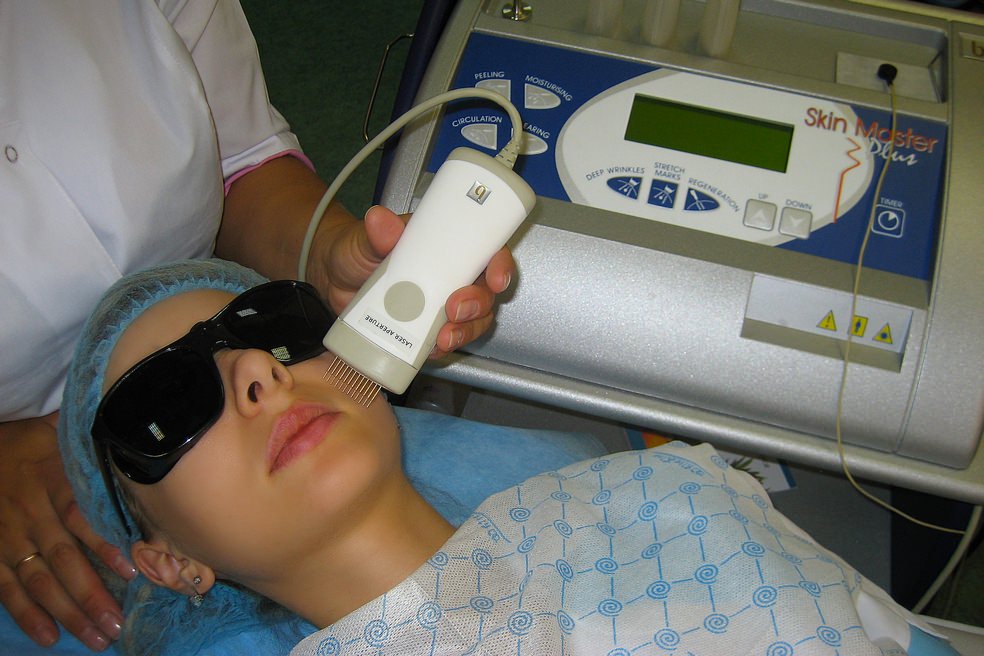 Ultrasonic facial machine jellen